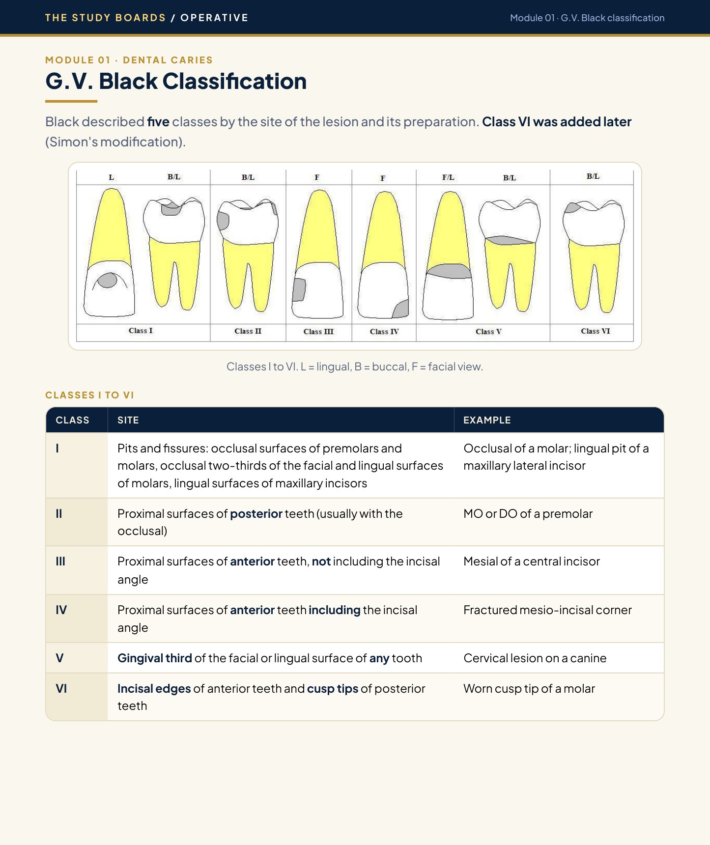 Study Boards Module page showing the G.V. Black classification with drawings and a table