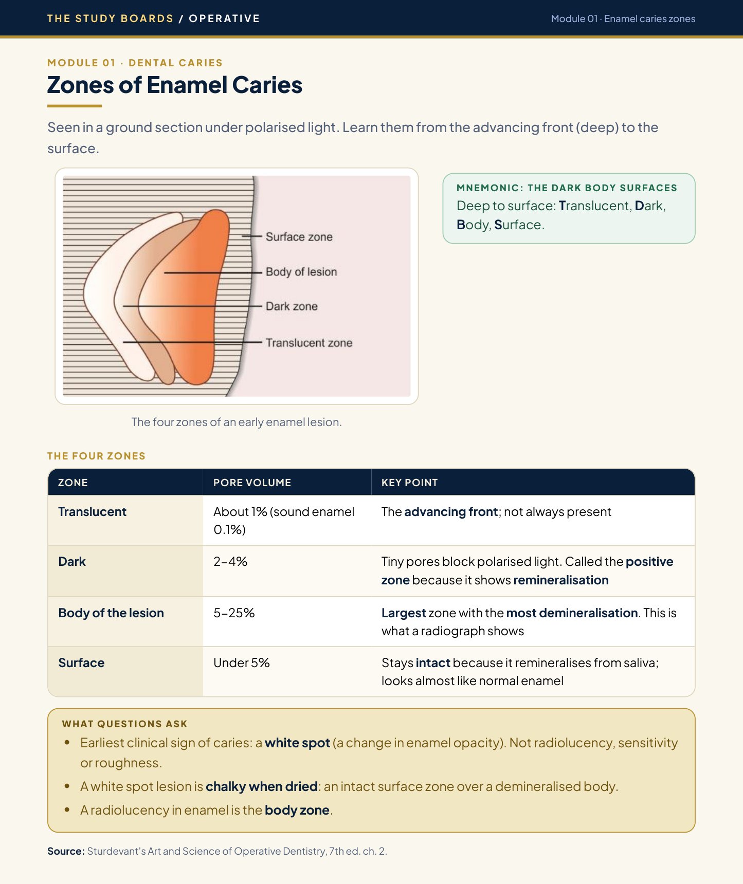 Study Boards Module page showing the four zones of enamel caries with a labelled diagram and table