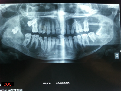 Figure for question