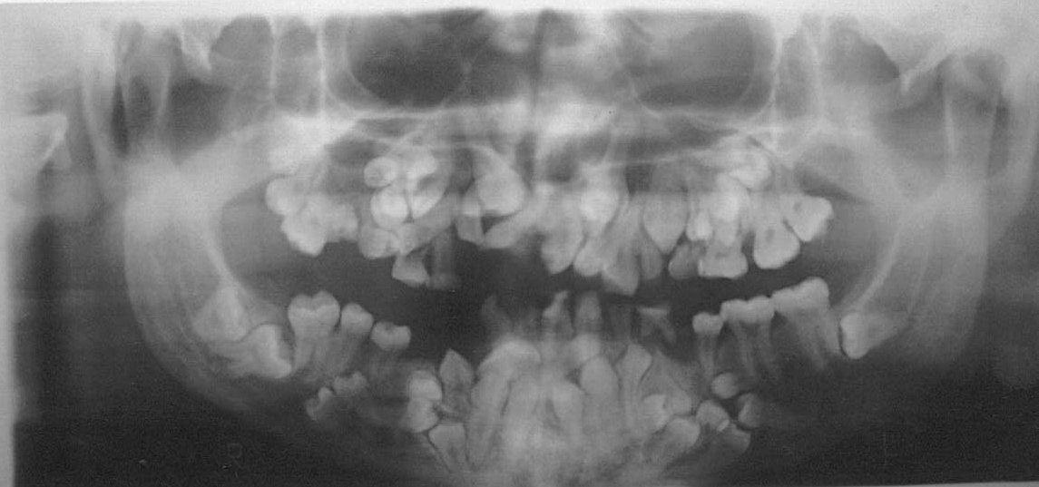 Figure for question