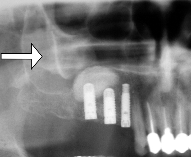Figure for question
